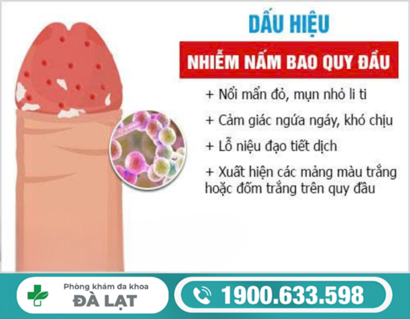 Hình ảnh minh họa